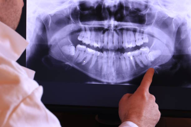 Best Emergency Tooth Extraction in Waynesboro, TN