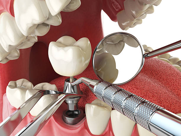 Best Emergency Treatment for Toothache in Waynesboro, TN